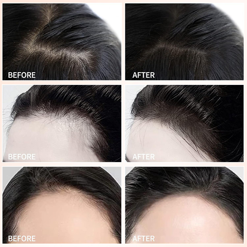 Hair line powder forehead hair supplement